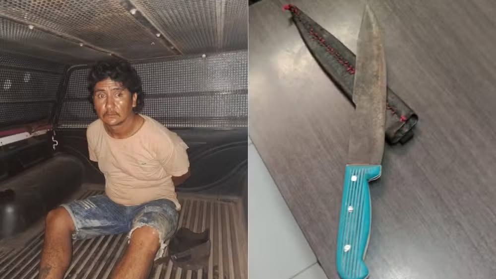 Peça metálica do sutiã evita ferimento mais grave após mulher levar facada do companheiro no MA, diz polícia